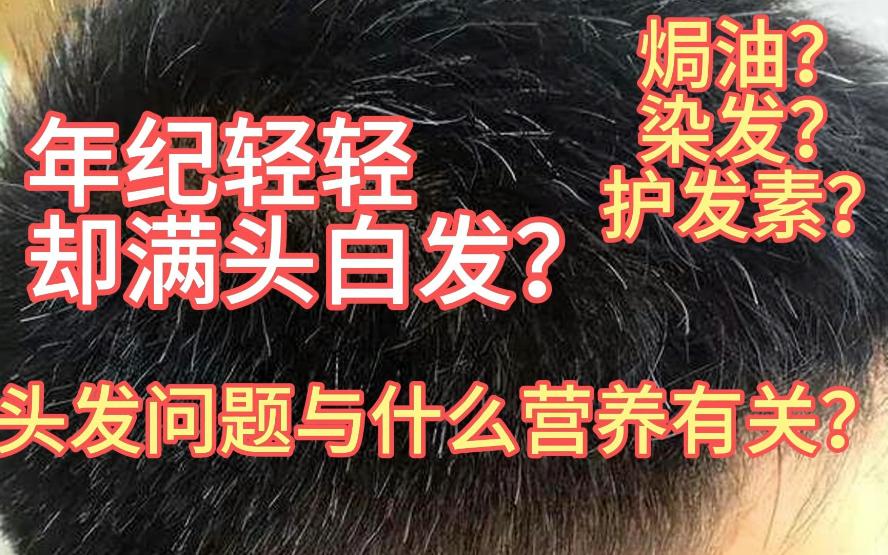 年纪轻轻却满头白发？