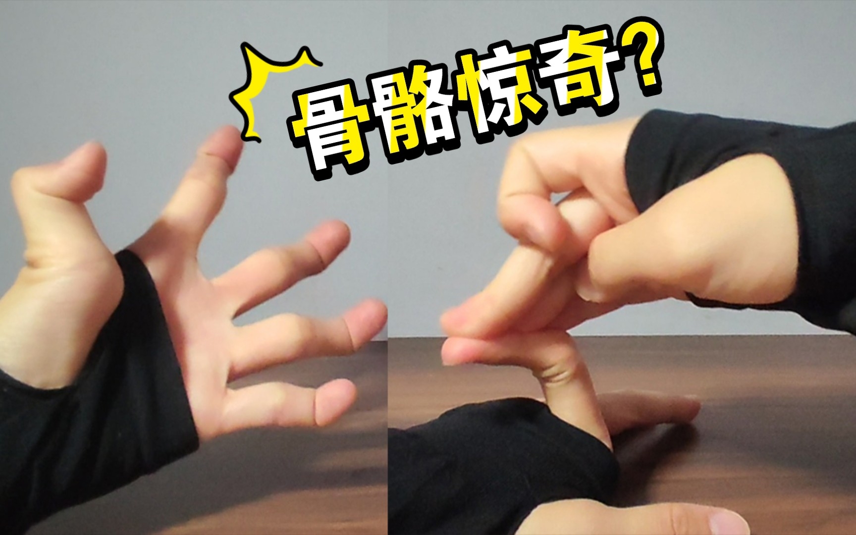 手指向后弯曲？骨骼惊奇？其实是一种病？
