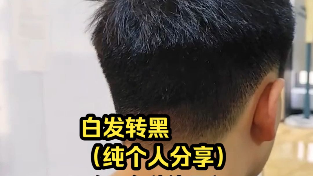 白发转黑需要一点耐心，亲测两年有效。