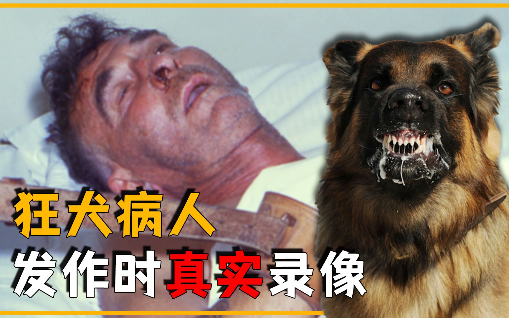 狂犬病患者发作时，全过程的真实录像，狂犬病毒究竟有多恐怖？