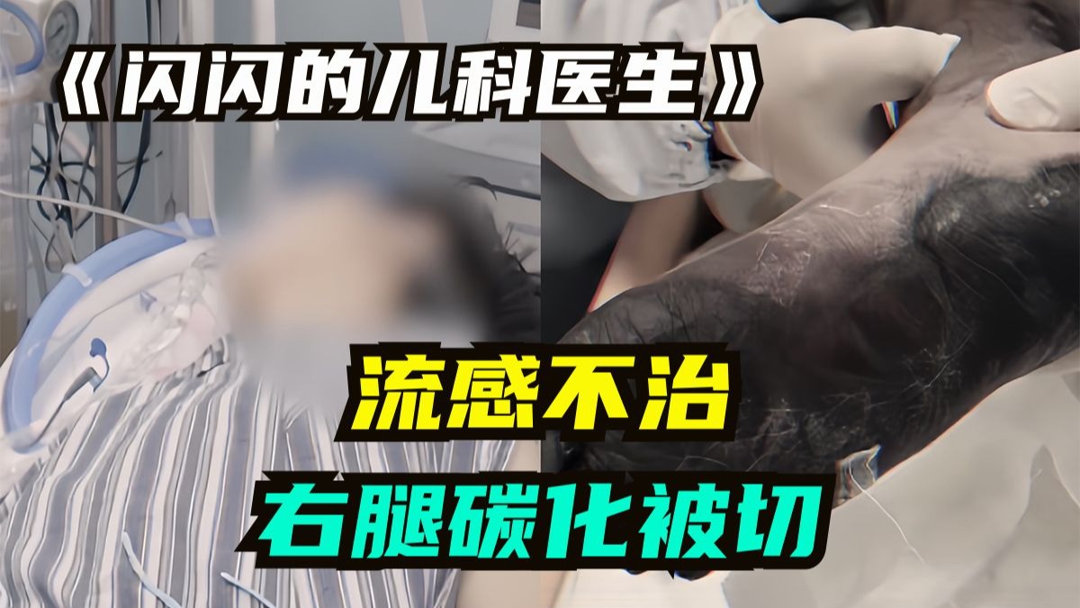 流感持续48个小时，竟然危及生命，切腿都算最好的结果！