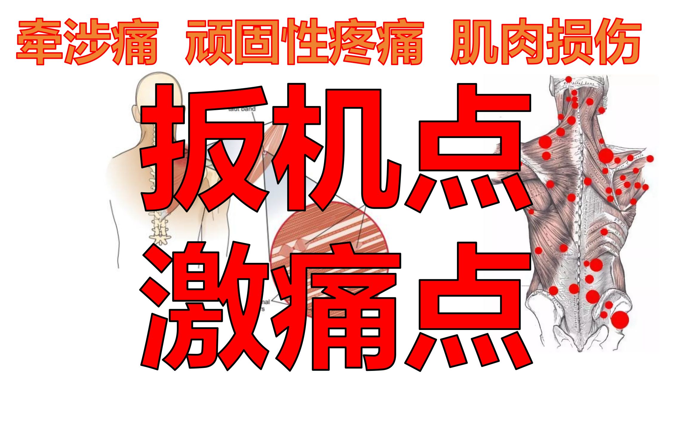 与大部分疼痛有关的扳机点（激痛点）是如何产生的？