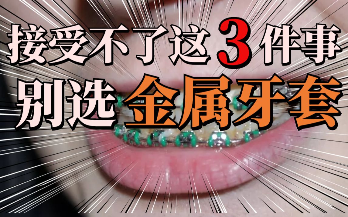 钢牙真的比隐形牙套好吗？牙套脸又容易蛀牙是真的吗？