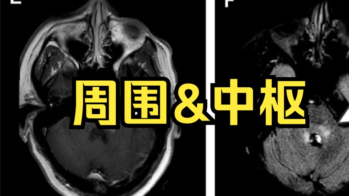从基础到实战 周围&amp;中枢性眩晕诊疗精讲 眩晕相关的前庭解剖及生理基础