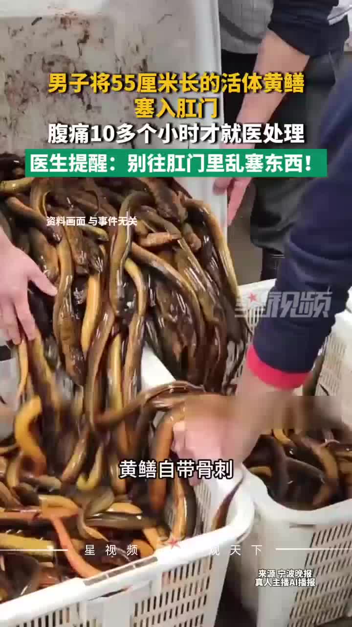 男子将55厘米长的活体黄鳝塞入肛门，腹痛10多个小时才就医处理