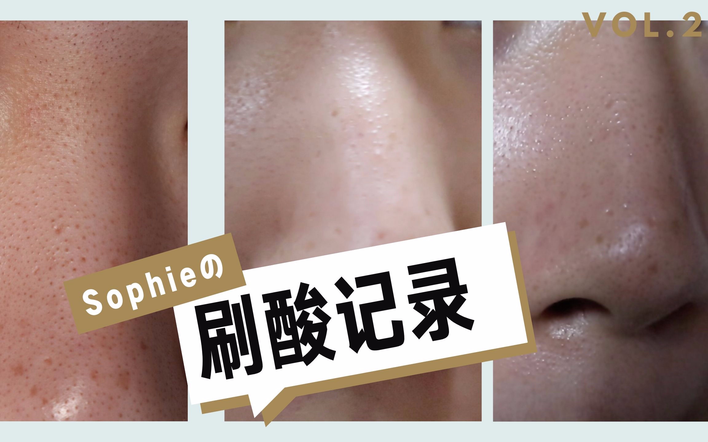 【Sophie】宝拉水杨酸 刷酸记录