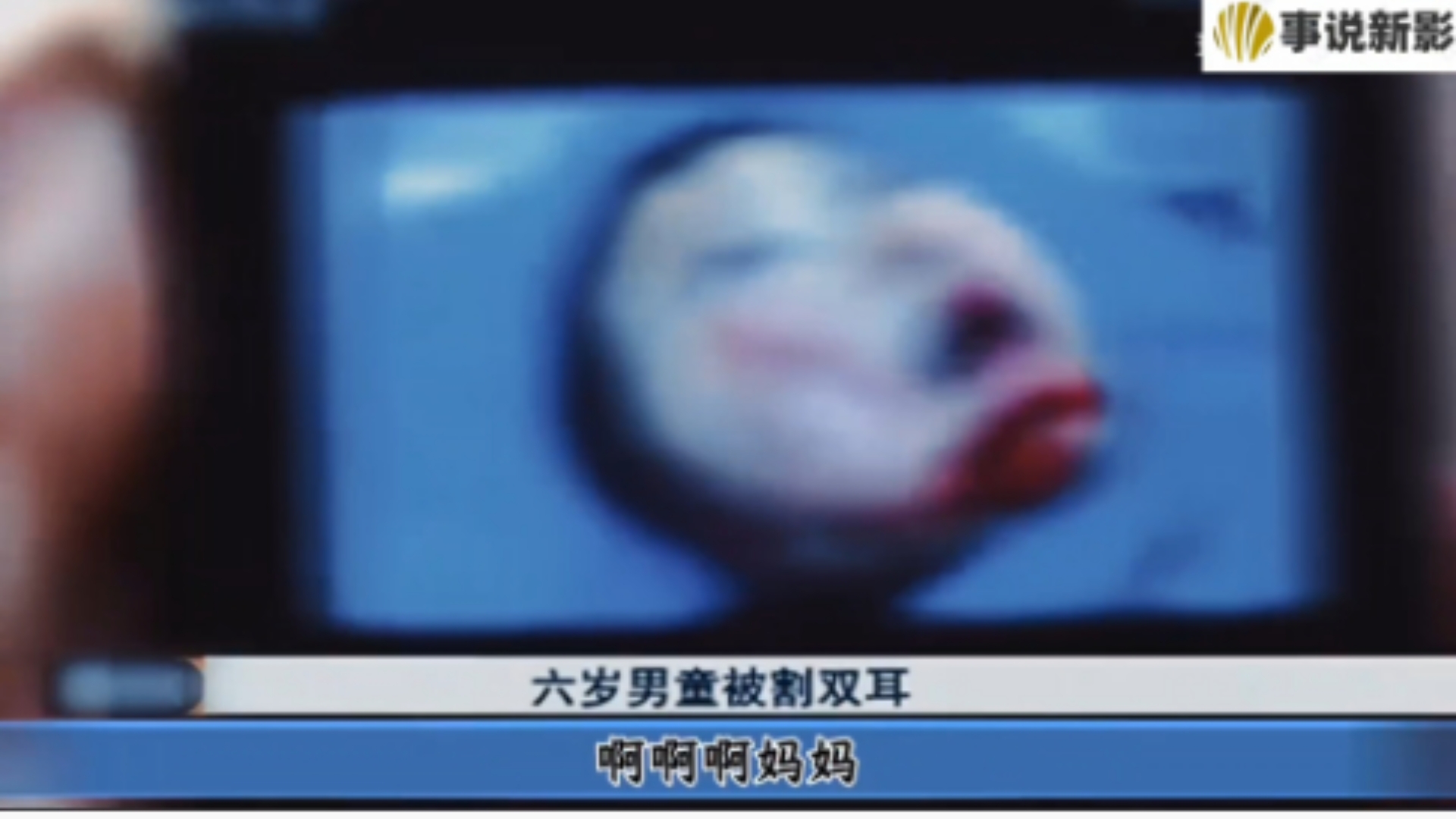 六岁男孩被亲二婶割掉双耳丢到粪坑！家人之间的恩怨矛盾，却拿孩子出气！