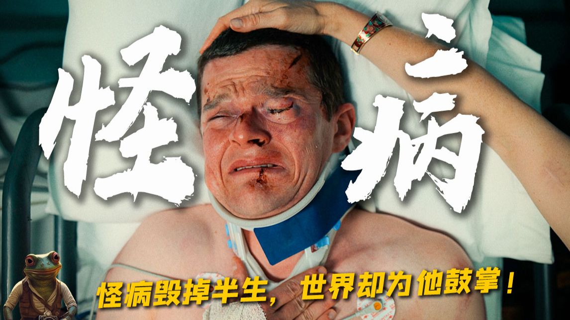 他张嘴就骂！天生不受控的抽搐绝症！却让世界为他起立鼓掌！——《妥瑞氏与我》
