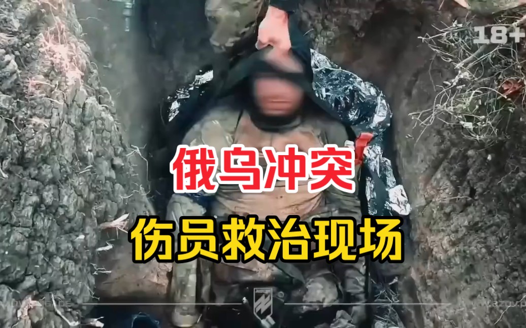 俄乌冲突，战地伤员救治现场