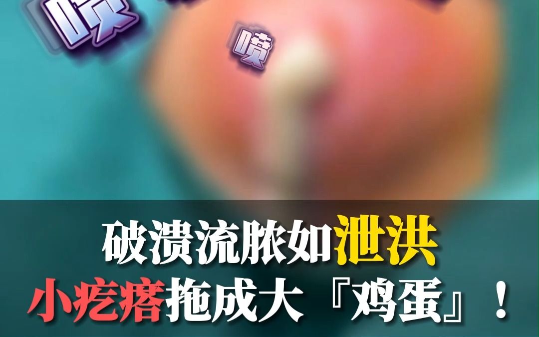 破溃流脓如泄洪，小疙瘩拖成大『鸡蛋』！
