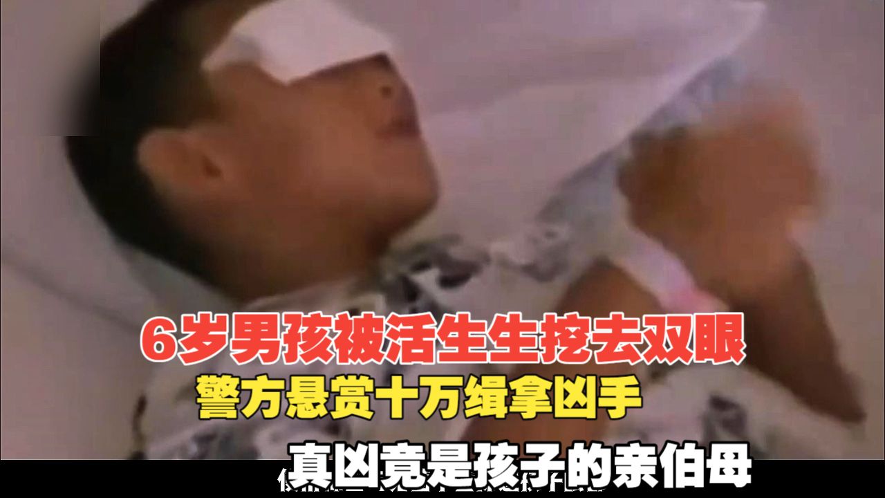 6岁男孩被活生生挖去双眼，警方悬赏十万缉拿凶手，真凶竟是孩子的亲伯母
