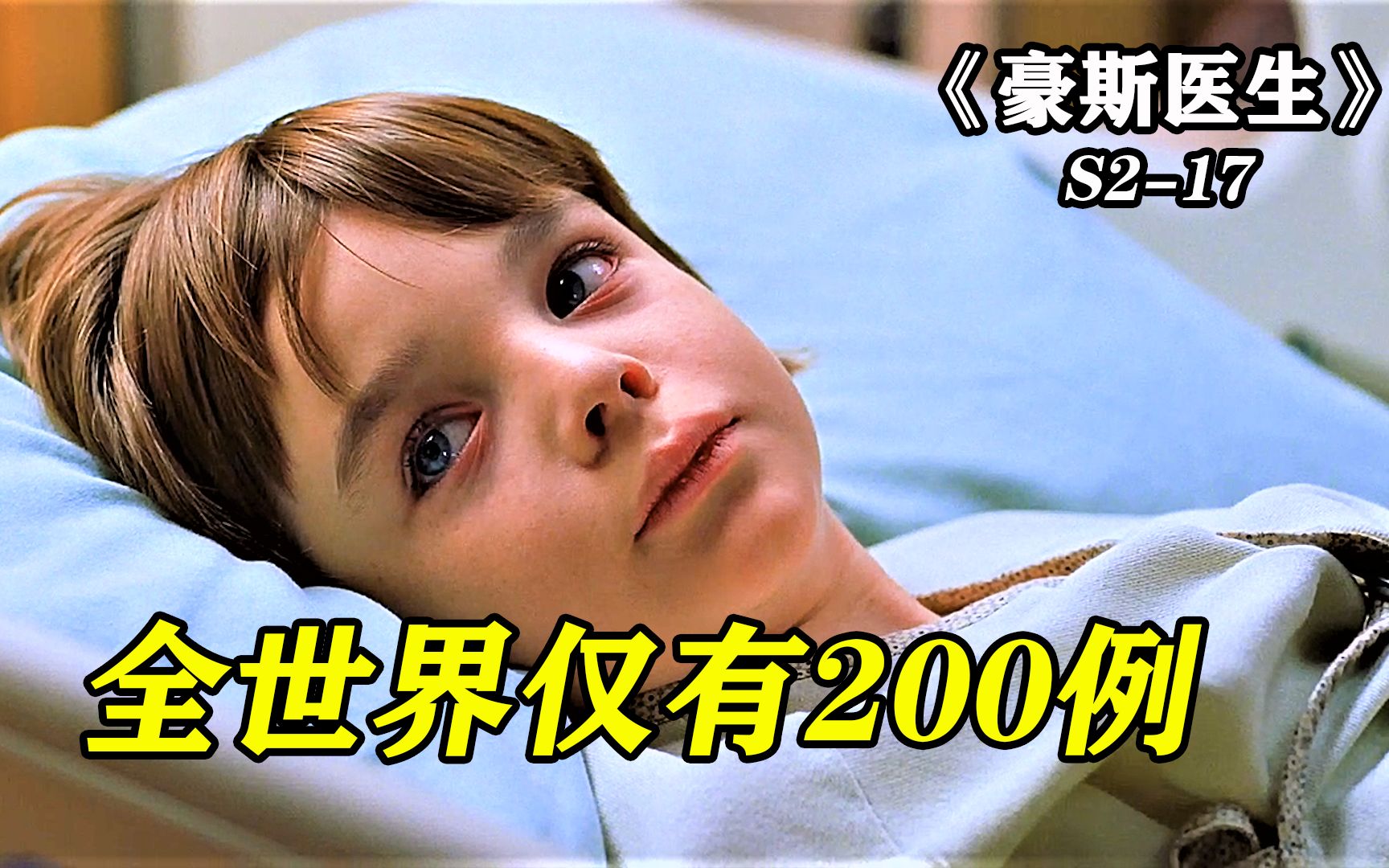 全世界仅有200例的罕见疾病，被男孩肖恩得上了，豪斯医生妙手回春！