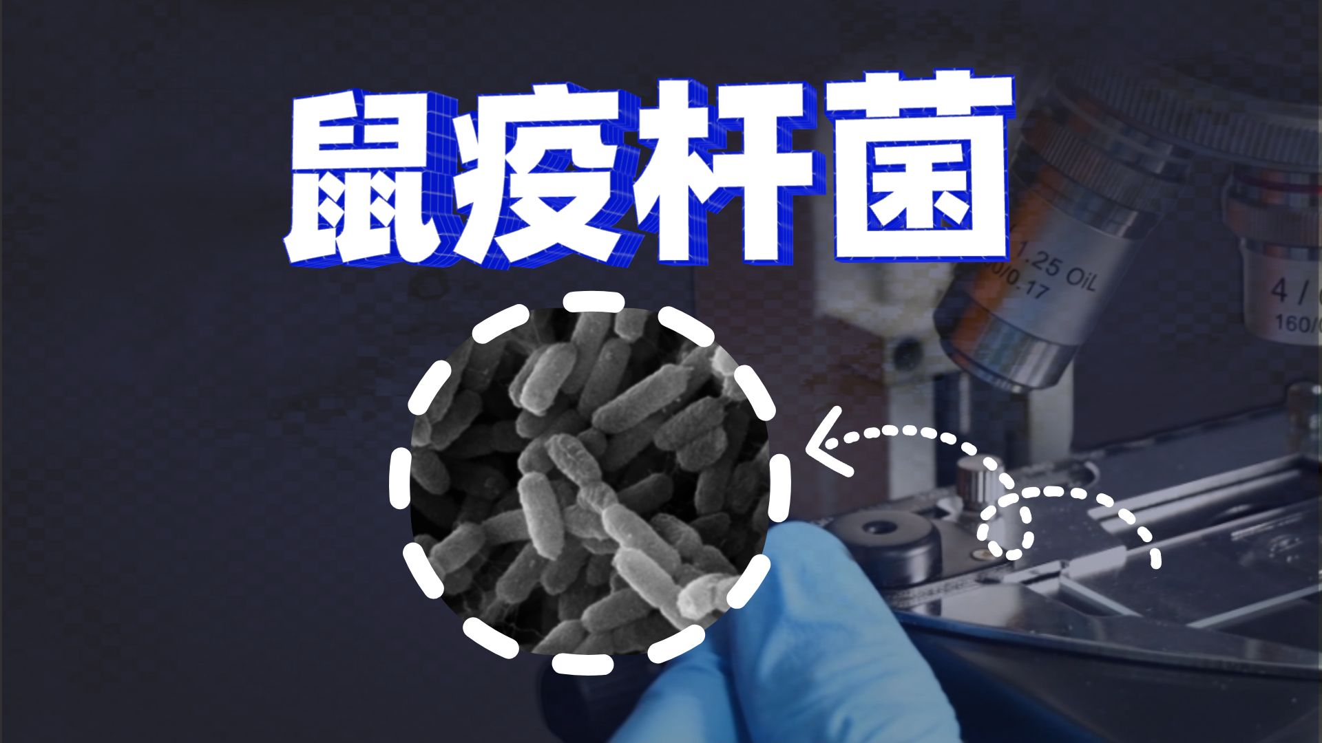 【实拍】导致上亿人死亡的烈性传染病