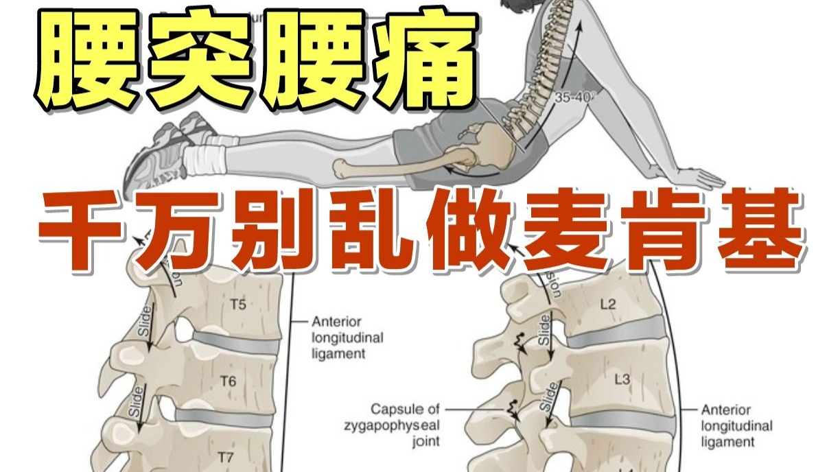 腰痛腰突，千万别乱做麦肯基！！