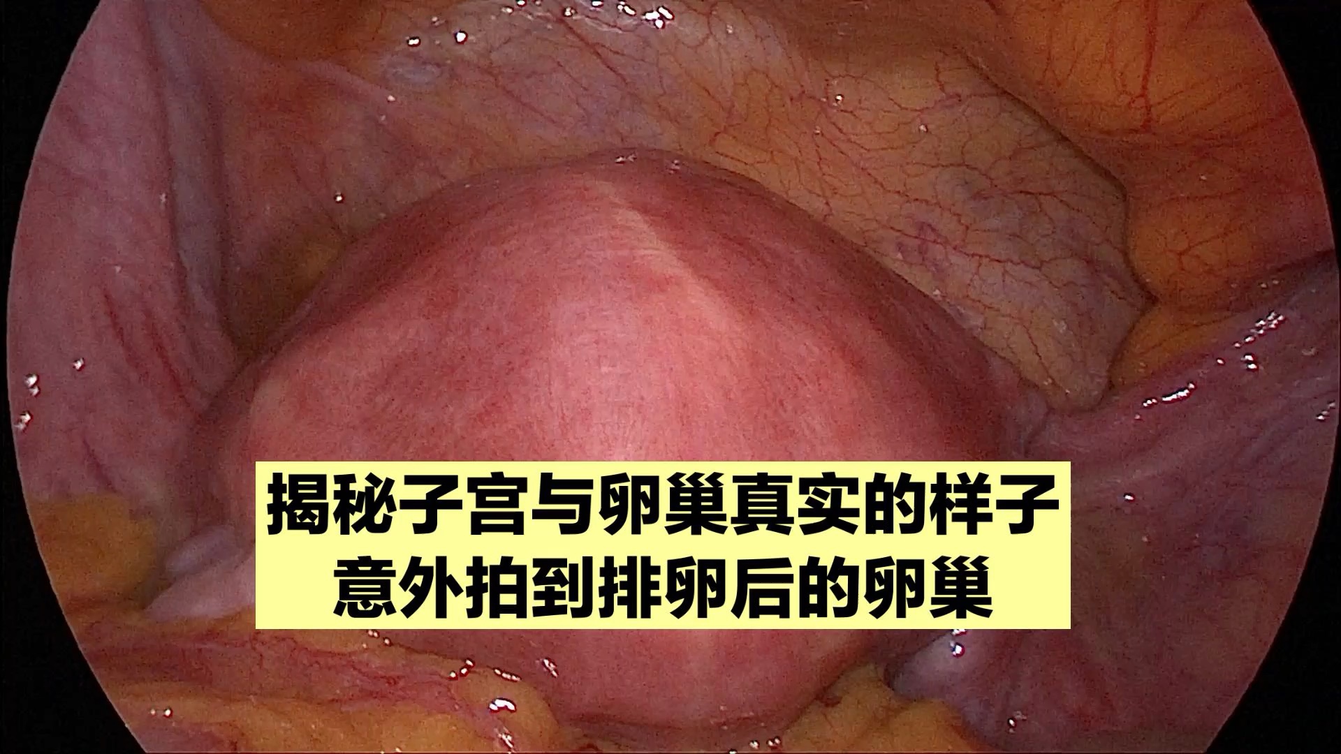 来看孕育生命的地方，真实的子宫和卵巢，可能跟你想象的很不一样