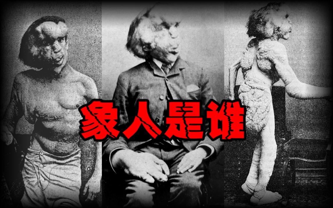【象人传奇】被剥夺人生的畸形者，真正的悲惨人生