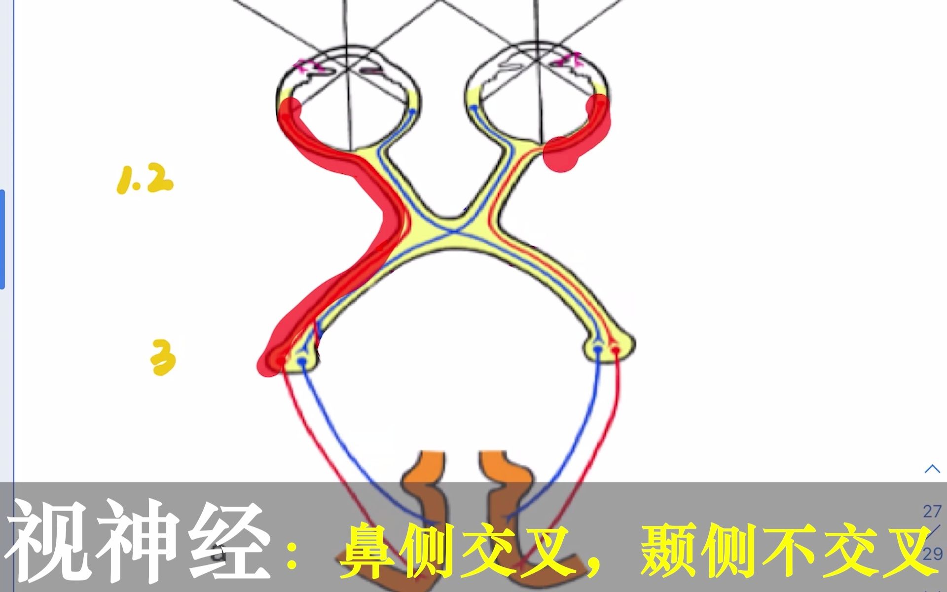 【人解三分钟】视觉传导通路：视野缺损+对光反射，视神经视交叉视束视幅射，画画图就懂