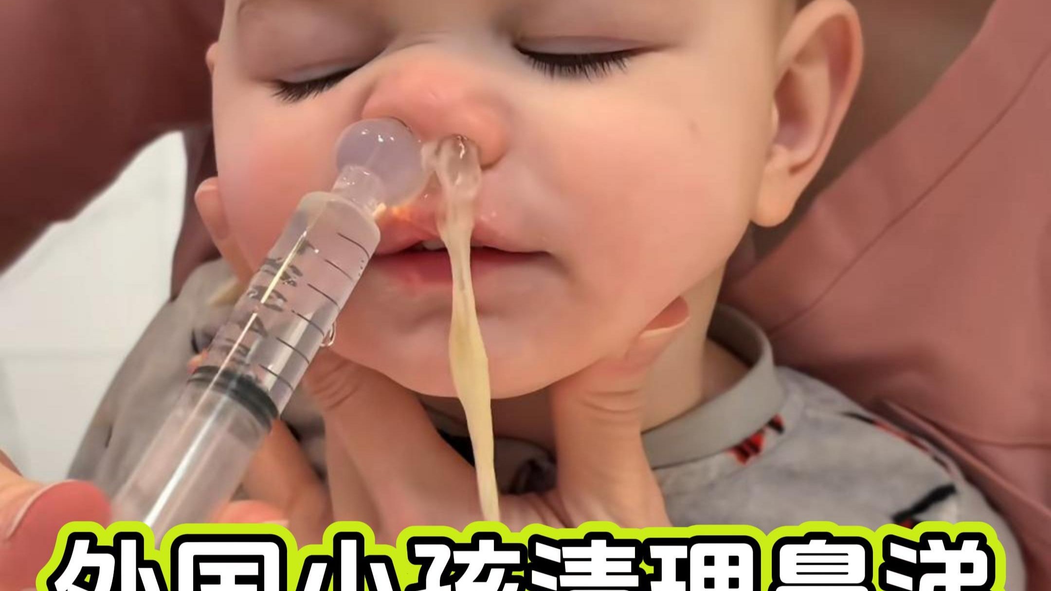 外国小孩鼻塞竟然是这样处理的