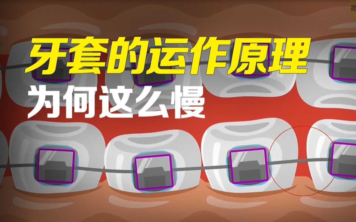 牙套的运作原理是什么？为什么这么慢，教科书~看完你也成专家！