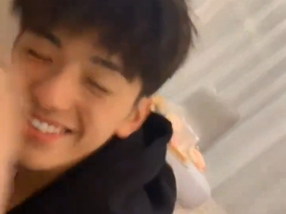 帅哥有点鸟面综合症…