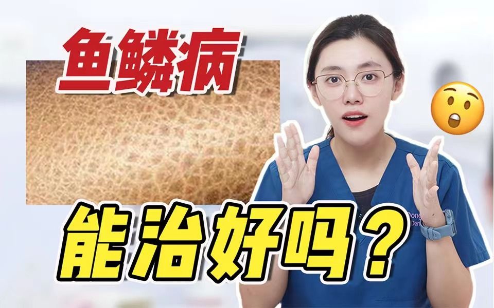 鱼鳞病到底是个啥