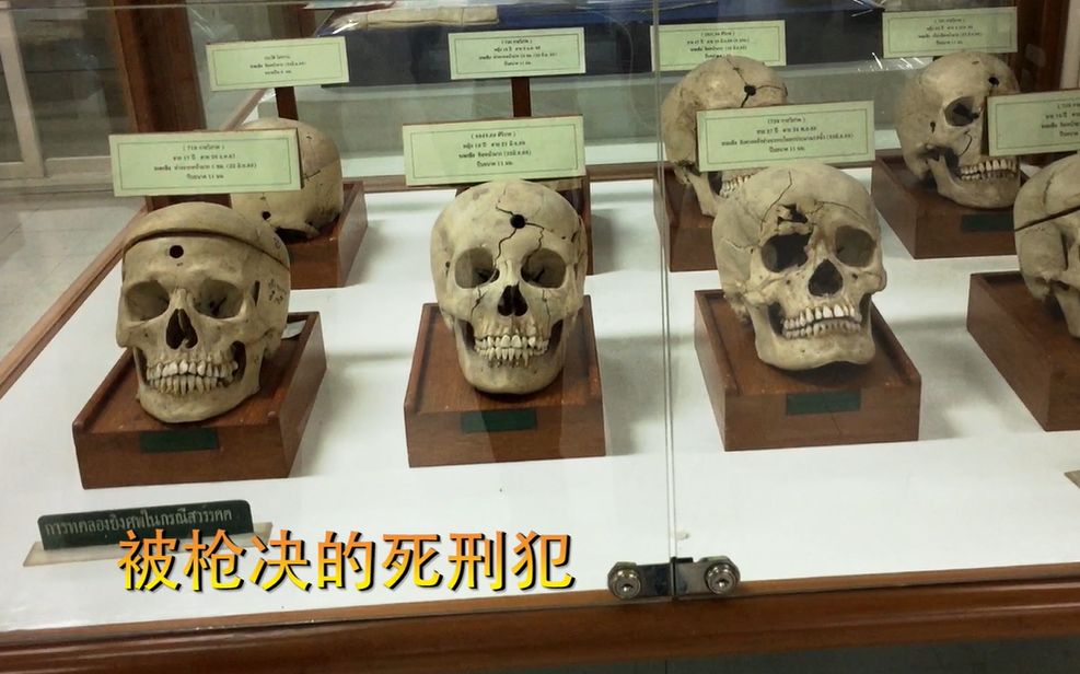医院藏尸！被抢决的死刑犯的头颅，脑袋真的是开花了！