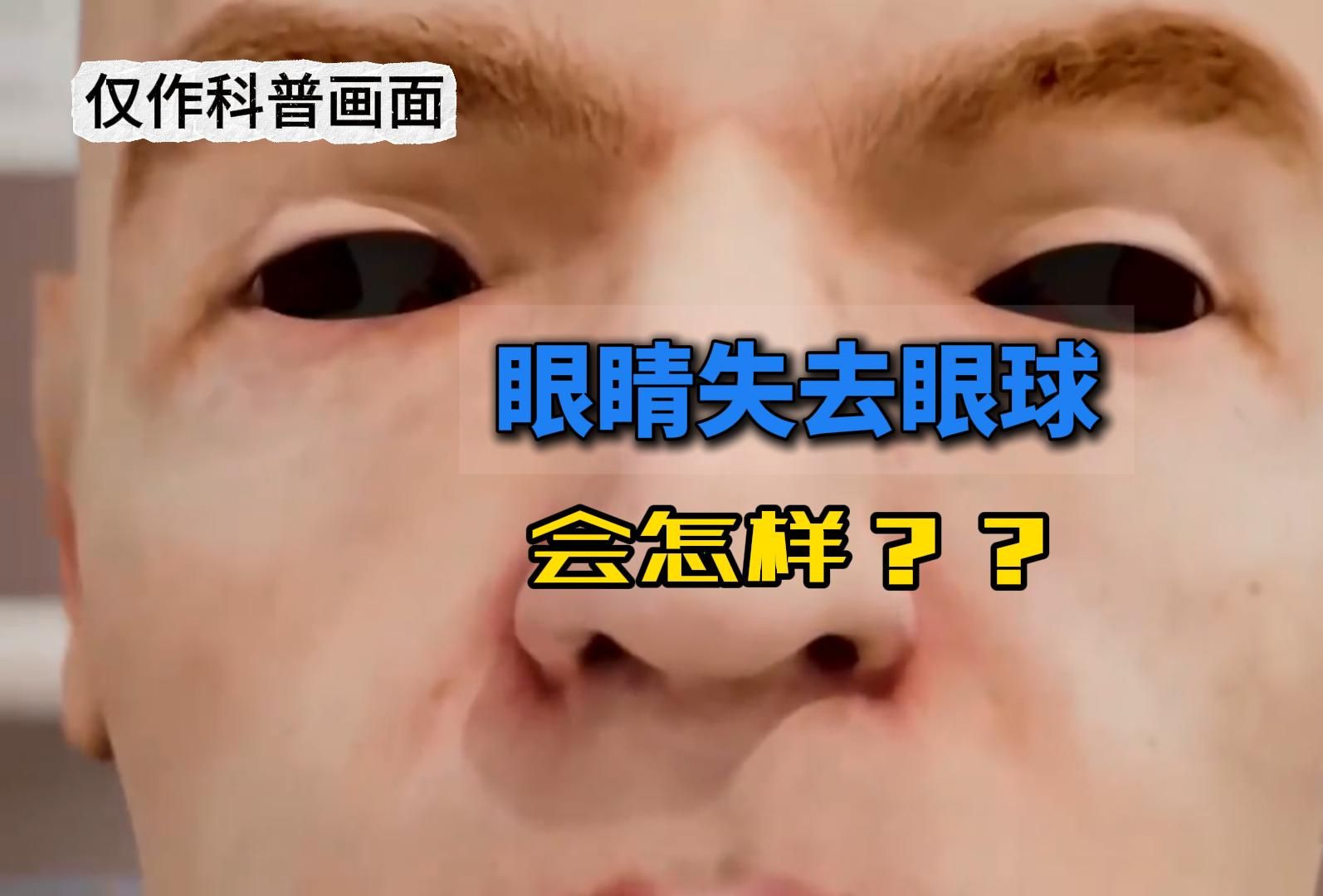 如果眼睛没有眼球看到的世界是什么样的？
