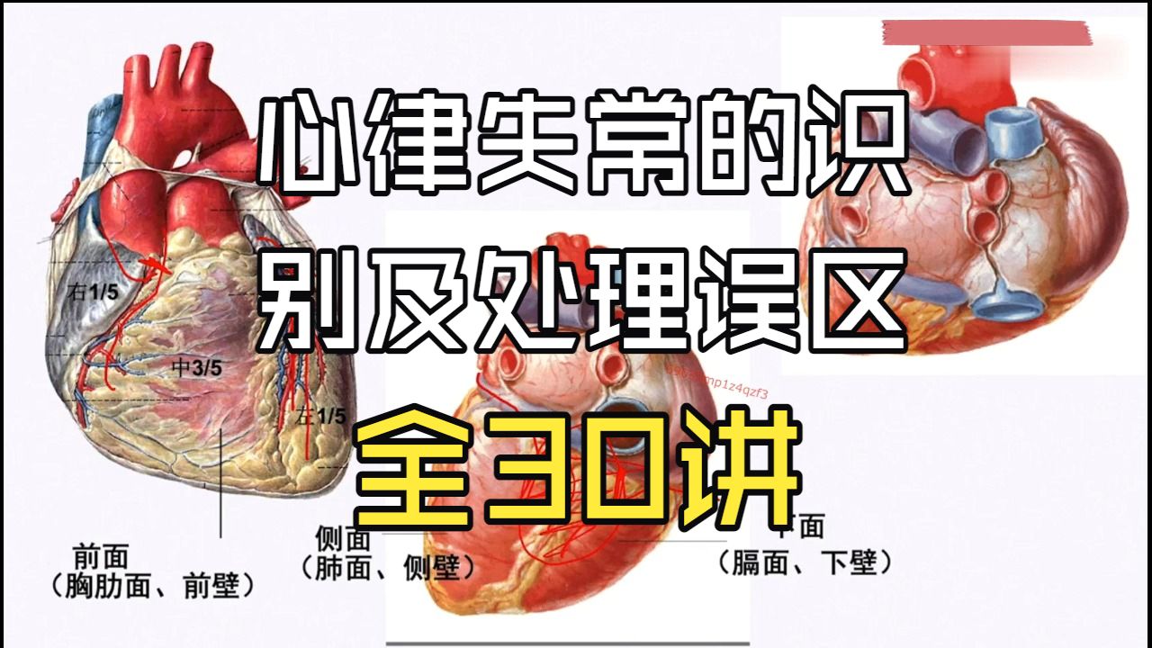 【全30讲】心律失常的识别及处理误区