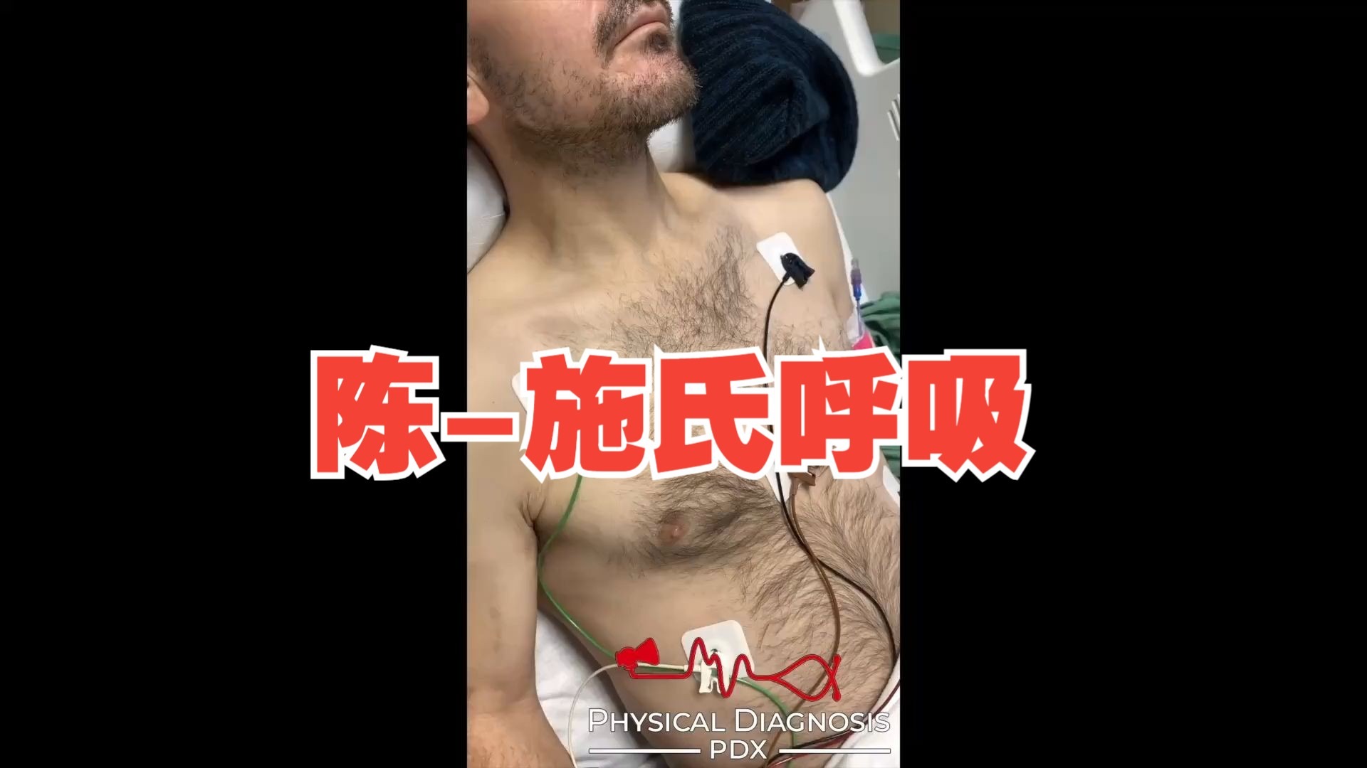 陈-施氏呼吸（Cheyne-Stokes respiration）| 临床思维