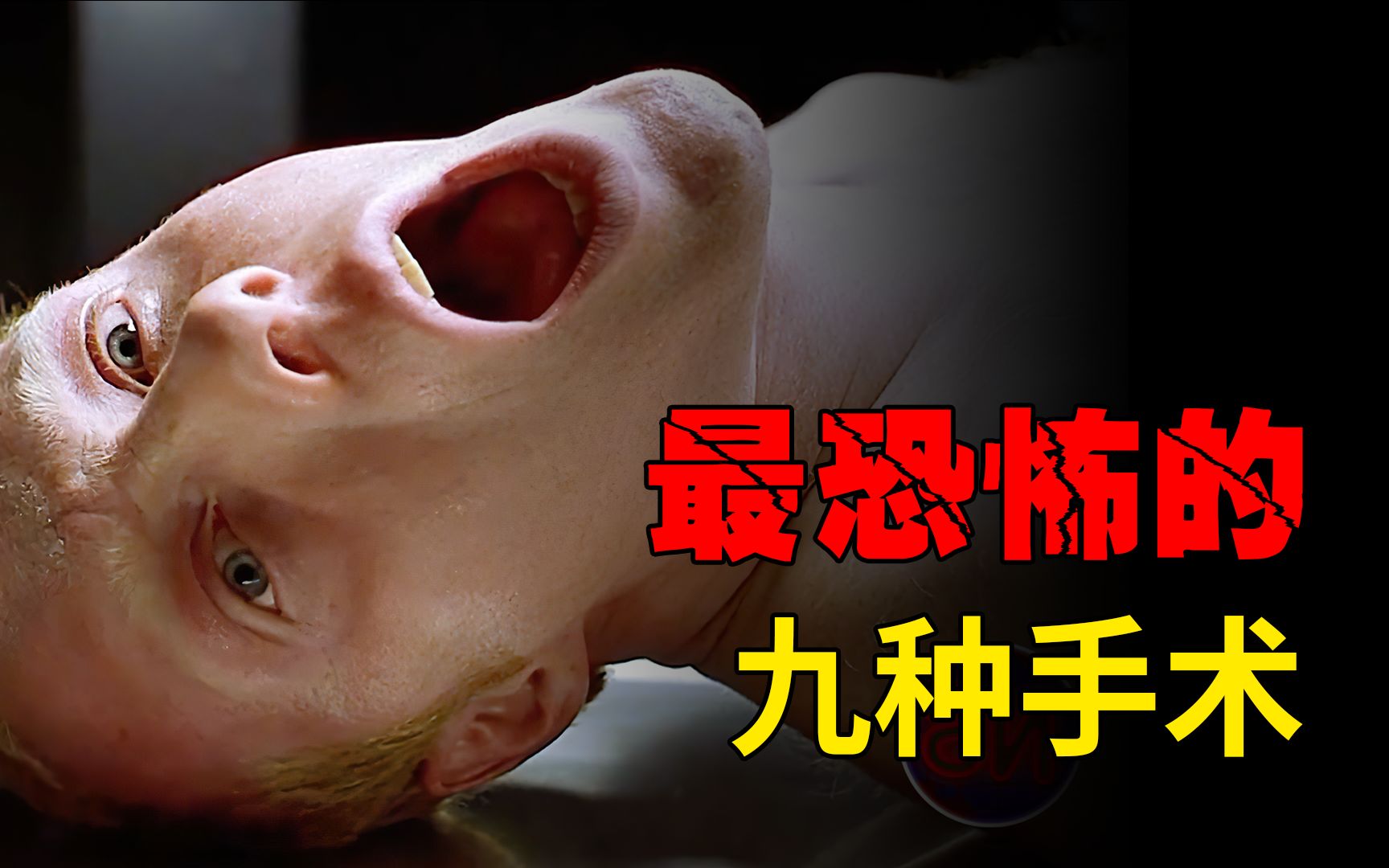 一辈子都不愿体验的九大恐怖手术，每一个都令人头皮发麻！